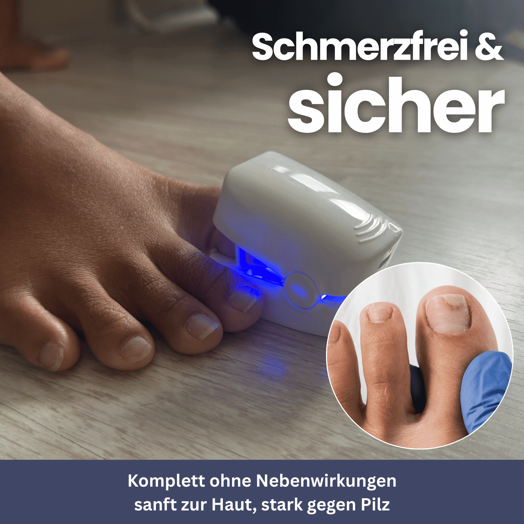 NailClip - Nagelpilztherapie-Gerät