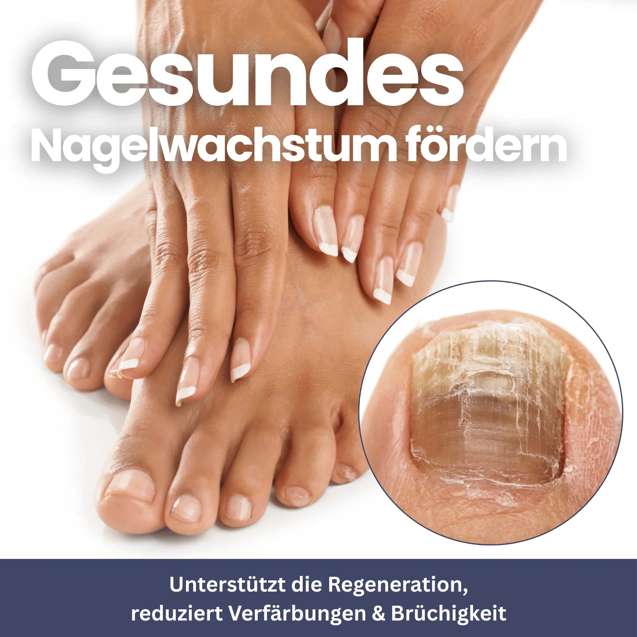 NailClip - Nagelpilztherapie-Gerät