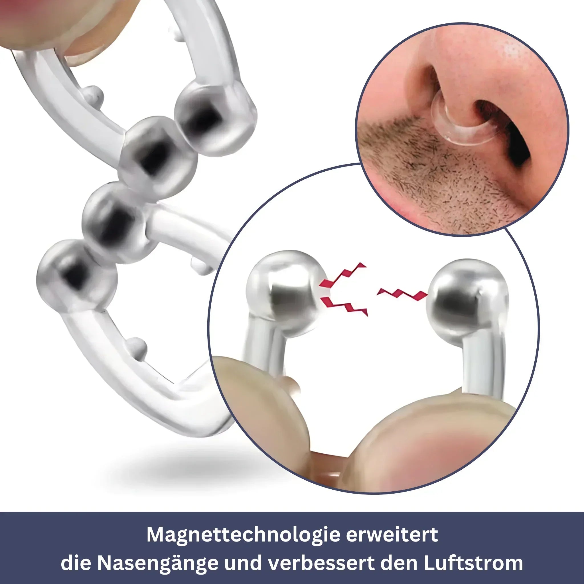 SilentBreeze – Magnetic Snore Stopper