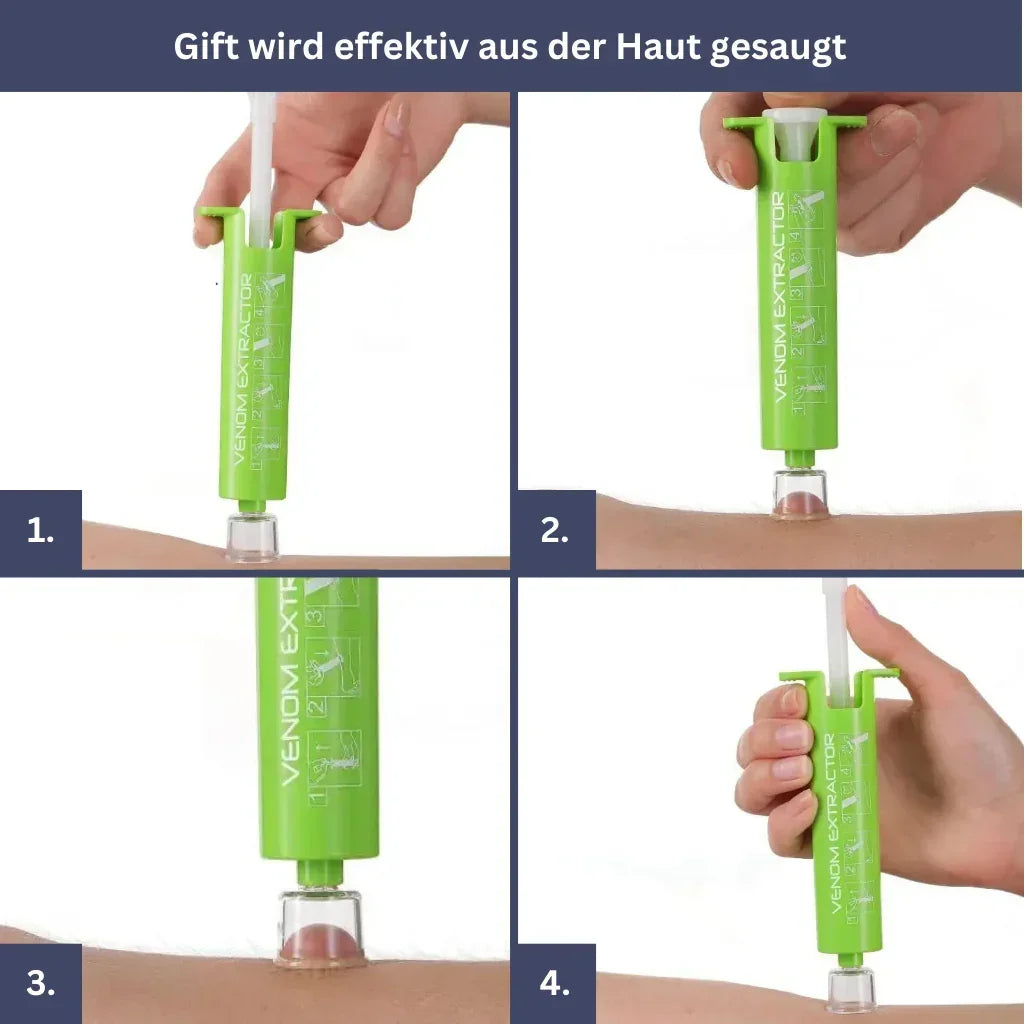 Anti Insekten Bundle - Stichheiler, Giftsauger, Mückenarmband