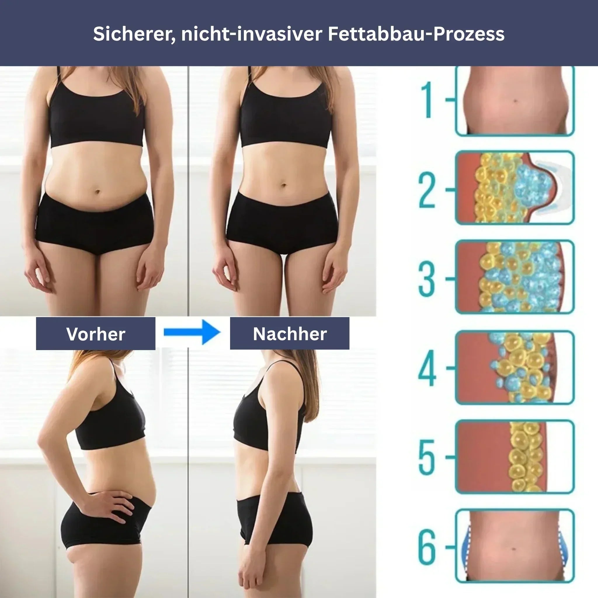 IceContour - Massagegerät für Bauch & Cellulite