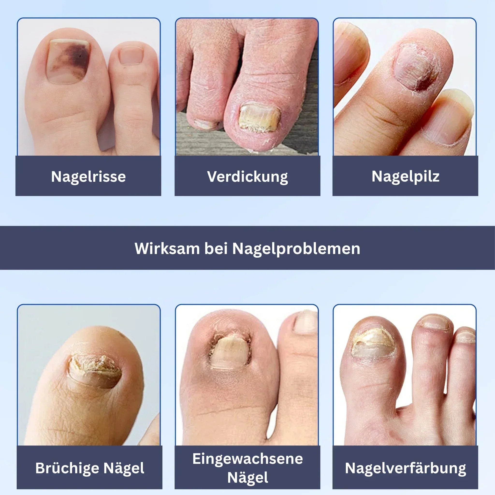 Nagelpflege Hydrogel-Patches