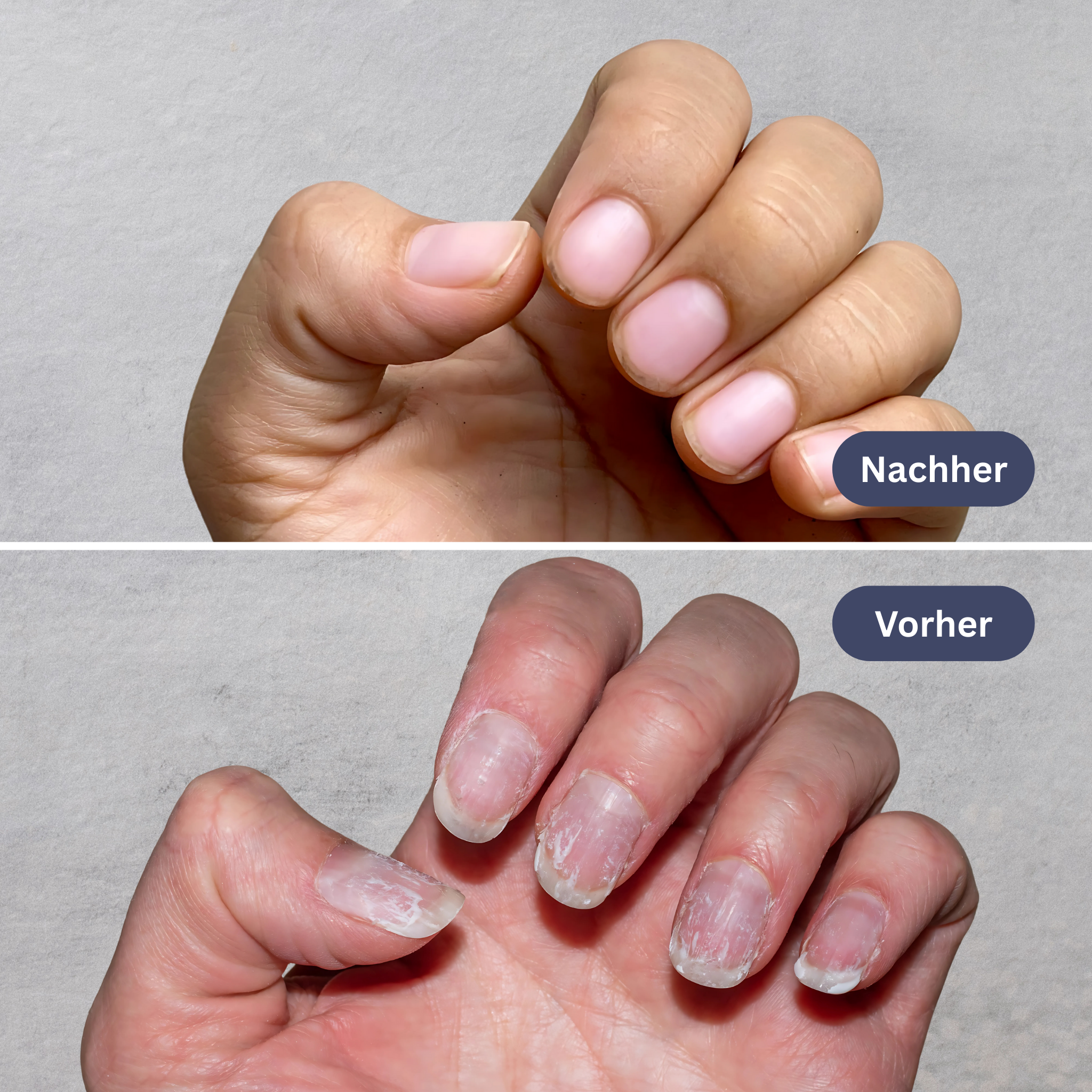 YILEST Natürlicher Nagelpflege-Stift