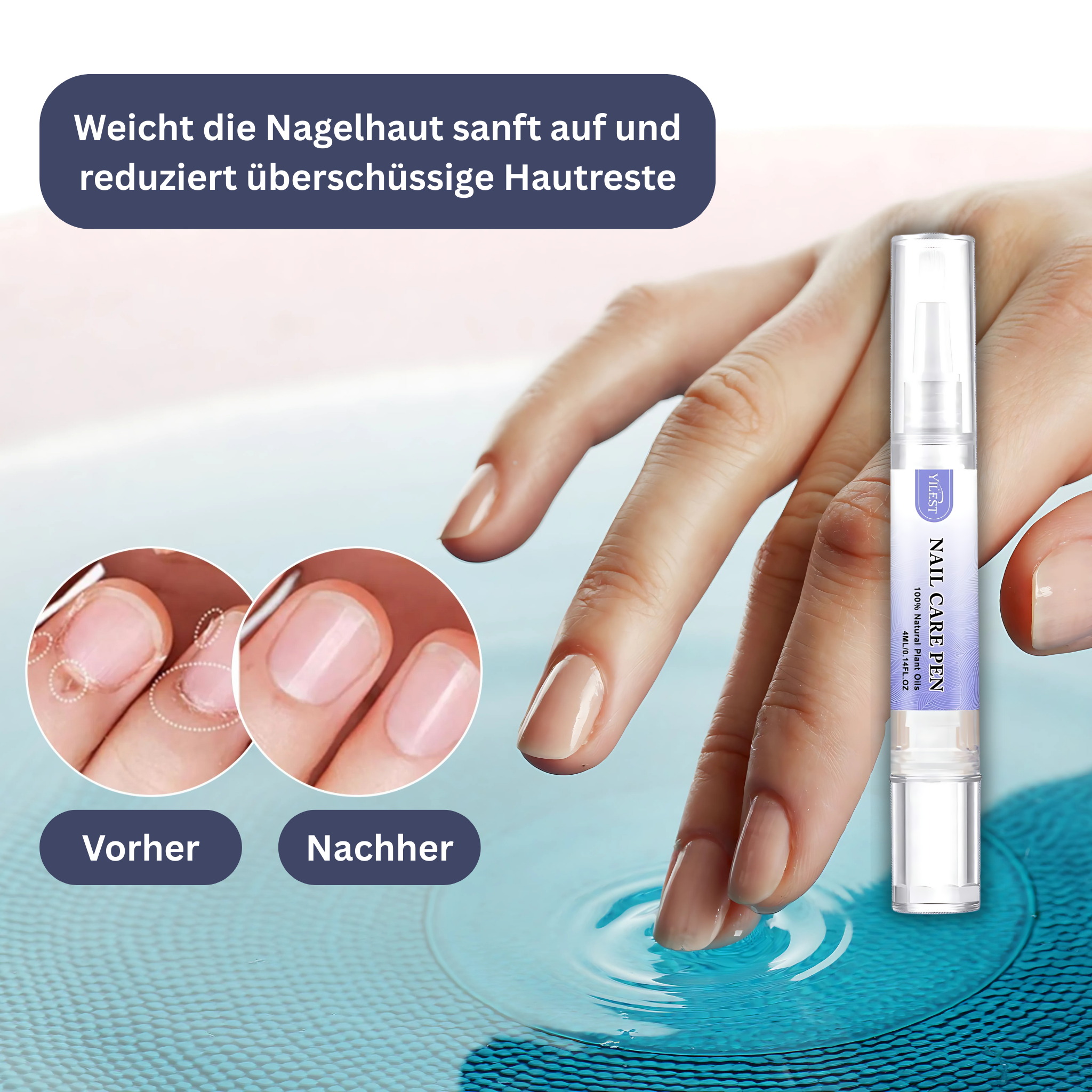YILEST Natürlicher Nagelpflege-Stift