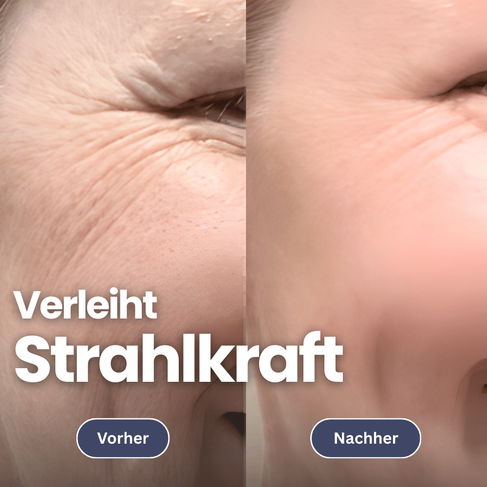 Microneedling Infusionset für eine straffe Haut